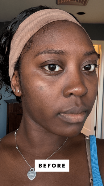 BlayTettey before applying the Celimax Jiwoogae Heartleaf BHA Peeling  Exfoliating Pads